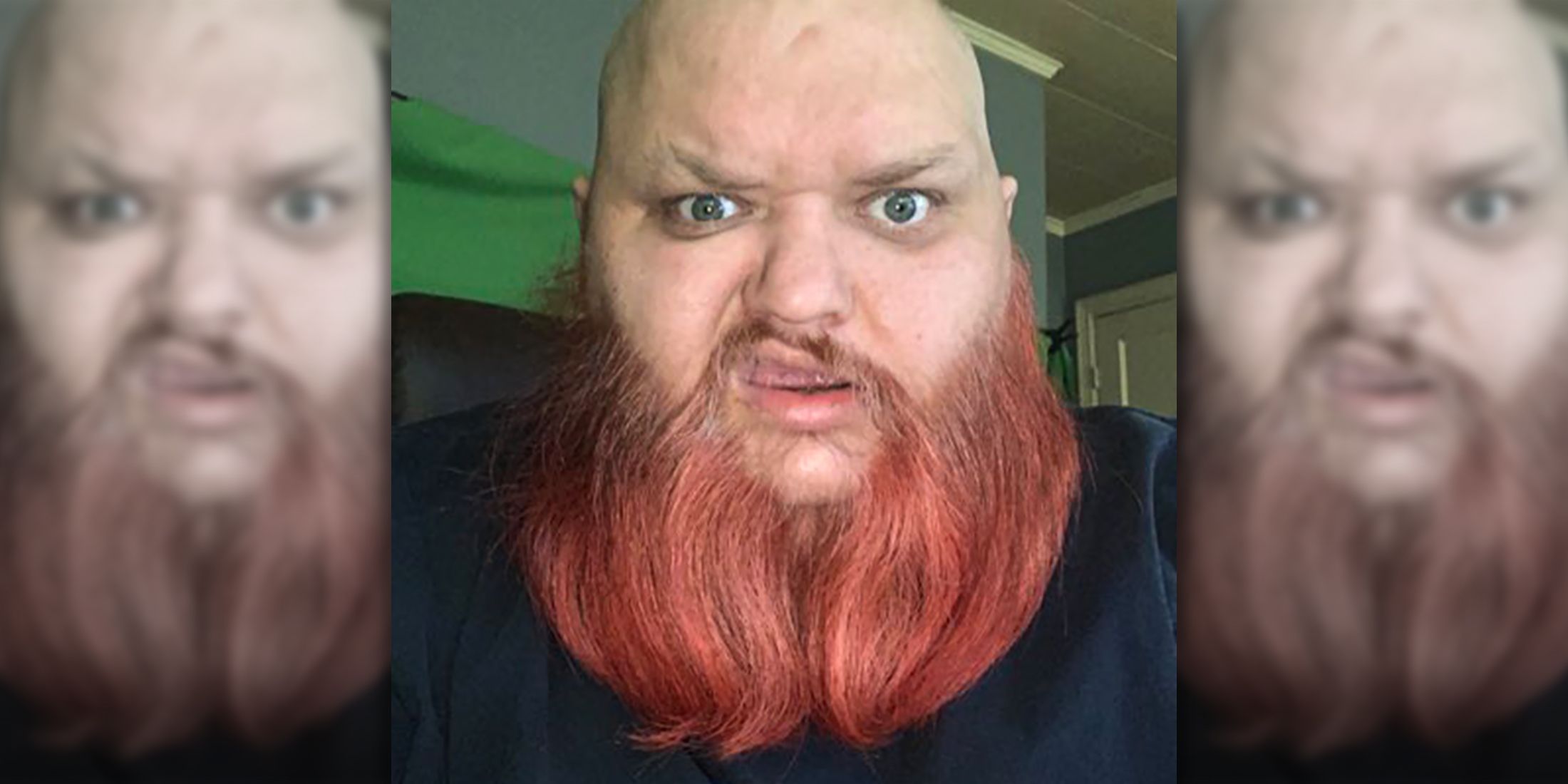 Звезда TikTok KingBeardX скончался в возрасте 47 лет.